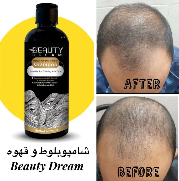 شامپوی تخصصی کنترل ریزش مو مدل بلوط قهوه - ۴۰۰ میل- Advanced Hair Loss Contro-بیوتی دریم
