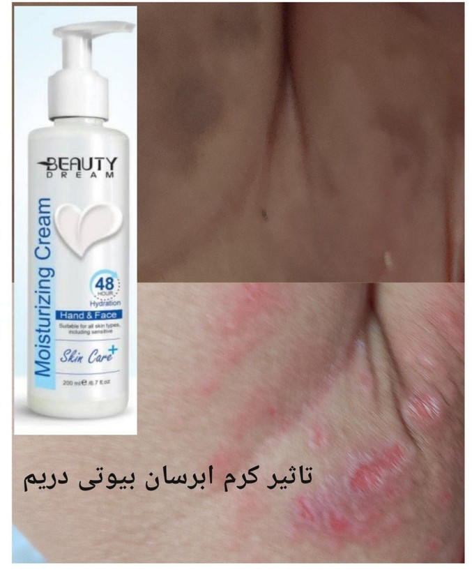 کرم آبرسان و مرطوب کننده - ۱۵۰ میل-بیوتی دریم