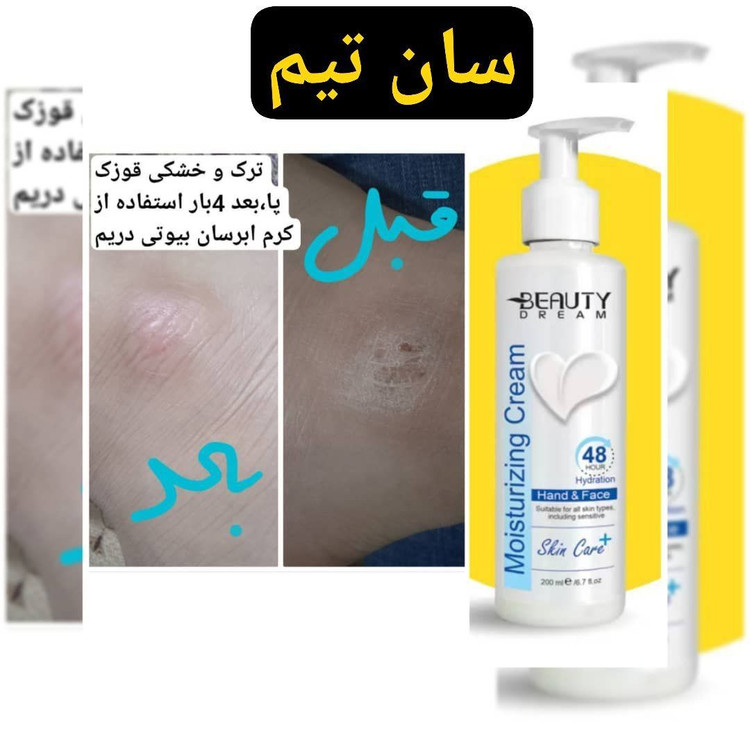 کرم آبرسان و مرطوب کننده - ۱۵۰ میل-بیوتی دریم