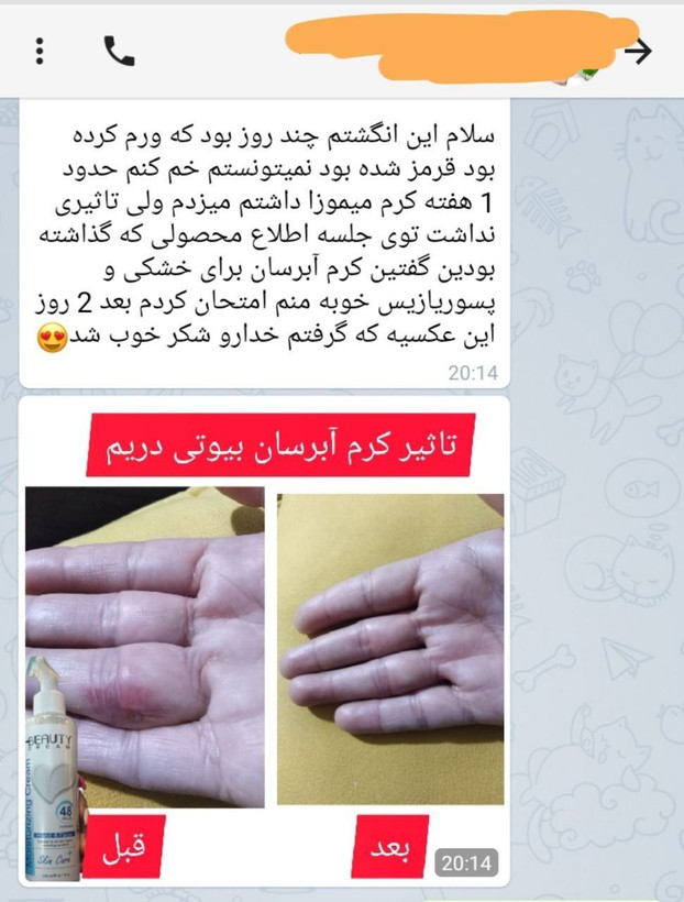 کرم آبرسان و مرطوب کننده - ۱۵۰ میل-بیوتی دریم